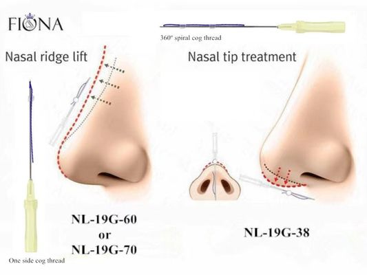 Fiona Nose Lifting Filling Pdo-Nasen-Faden absorbierbar mit stumpfem Cannula