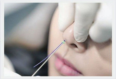 Fiona Nose Lifting Filling Pdo-Nasen-Faden absorbierbar mit stumpfem Cannula