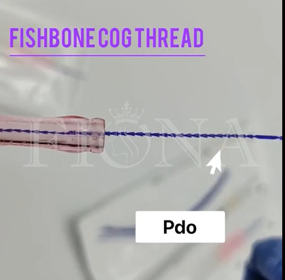 PDO-Fishbone-Formteil-Zahn-Faden für den Gesichts-Augen-Kontrollarm, der 18G100MM anhebt